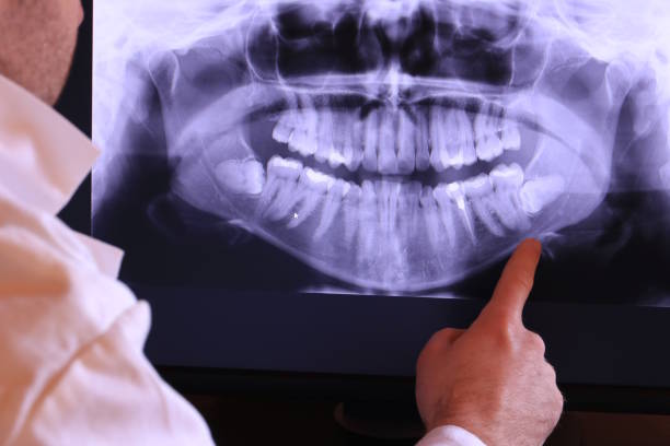 Best Pediatric Emergency Dentist in Kannapolis, NC