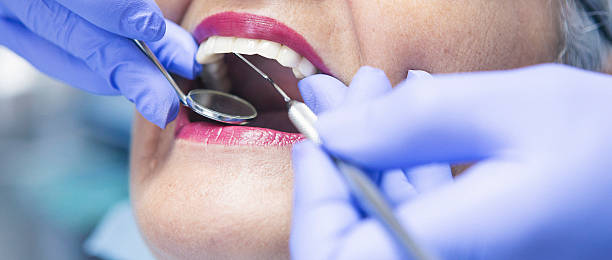 Best Emergency Wisdom Teeth Removal in Kannapolis, NC