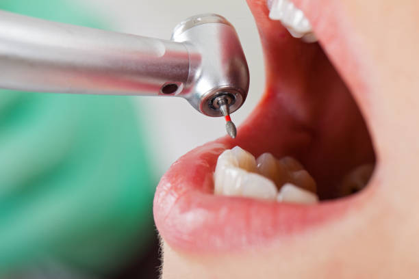 Best Emergency Gum Treatment in Kannapolis, NC